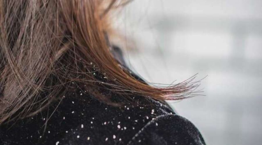 How To Protect Your Natural Black Hair In Winter?